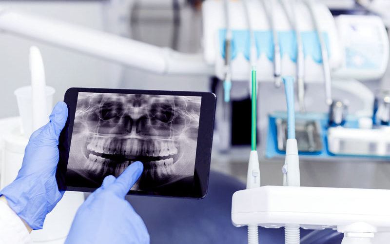 No overtreatment policy at Happy Light Dental