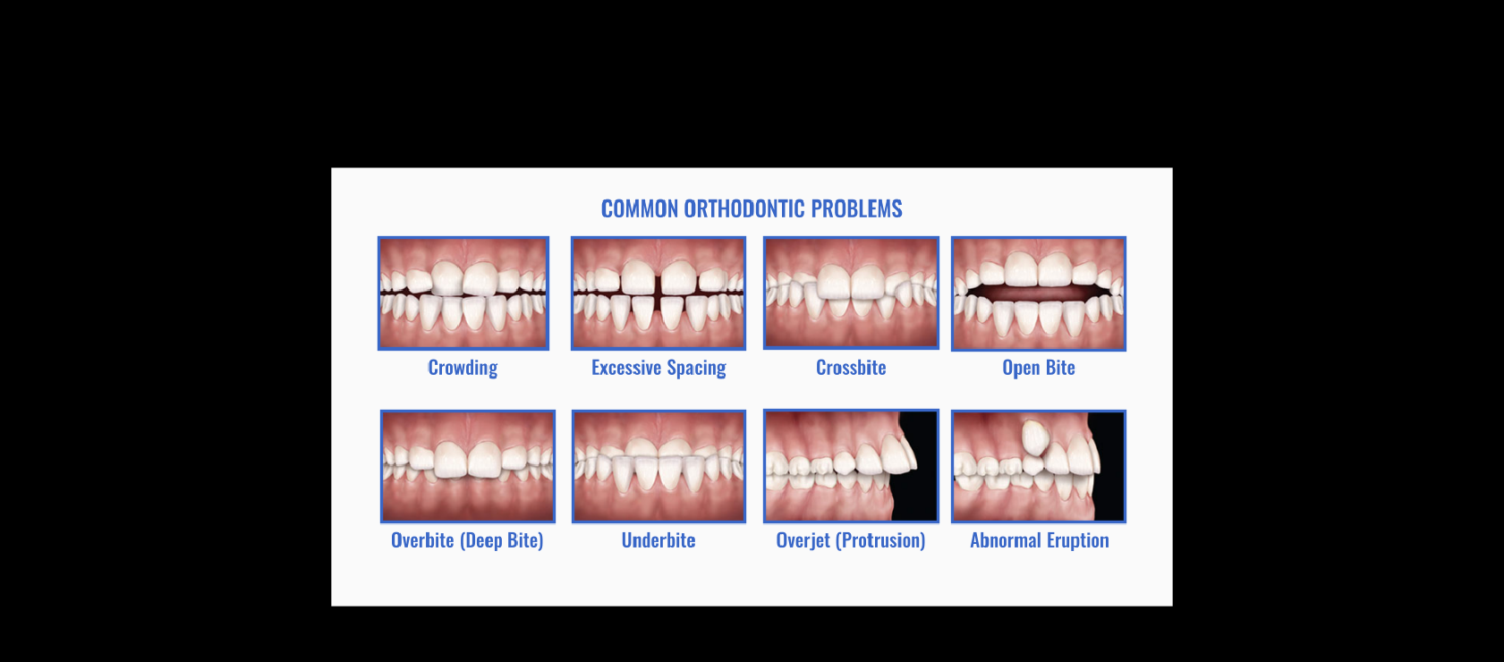 Common Orthodontic Problems that can be treated in Happy Light Dental, Hawthorne, CA, 90250