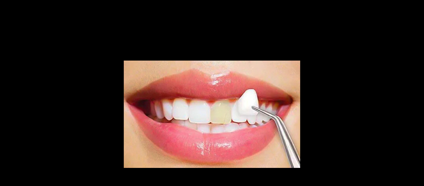 Cosmetic Dentistry in Happy Light Dental, Hawthorne CA, 90250