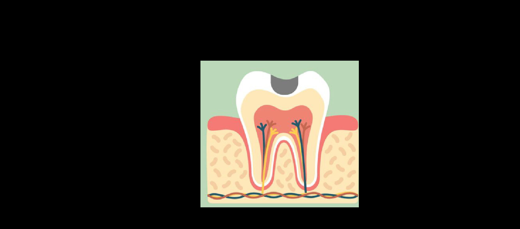 Dental Fillings: Step1 - Diagnosis in Happy Light Dental, Hawthorne, CA, 90250