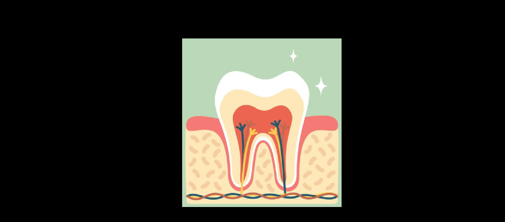 Dental Fillings: Step6 - Polishing and Adjustment in Happy Light Dental, Hawthorne, CA, 90250